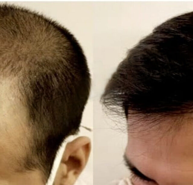 Before After - Image 1