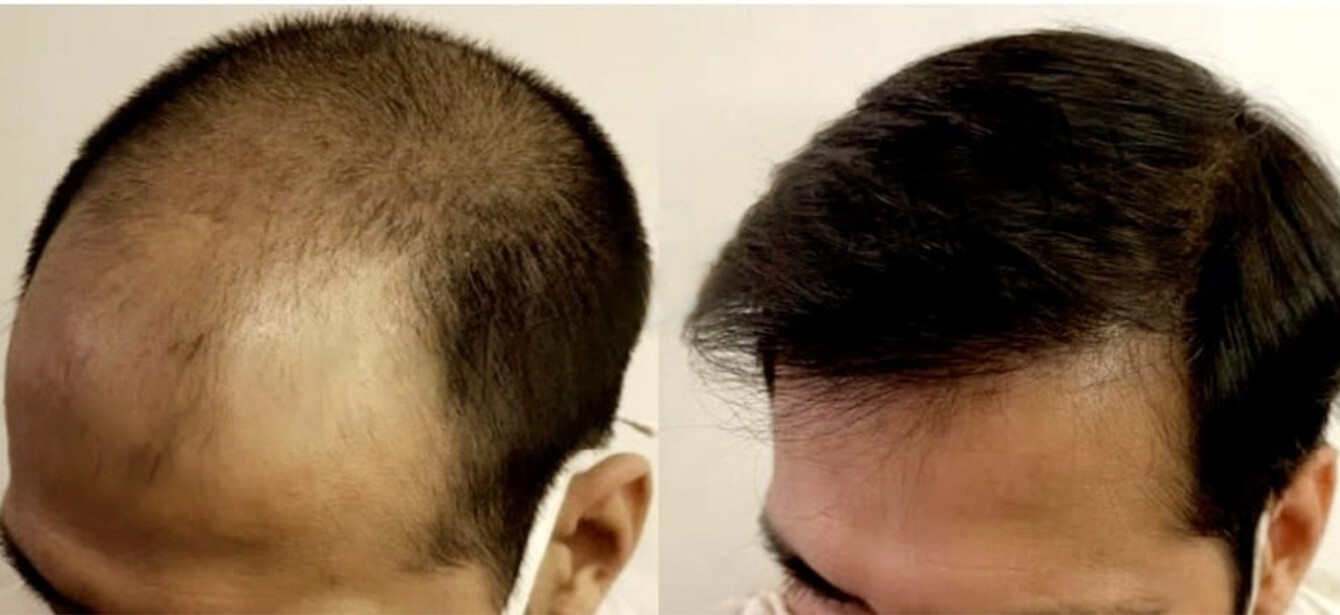 Before After - Image 1