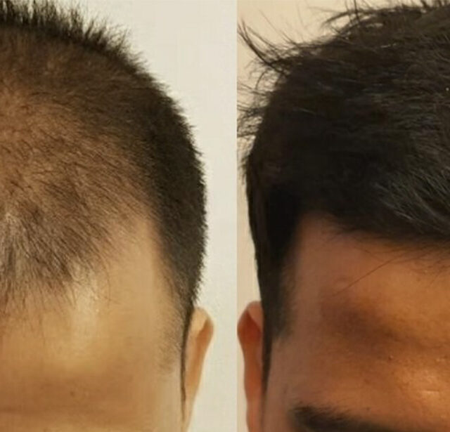 Before After - Image 2