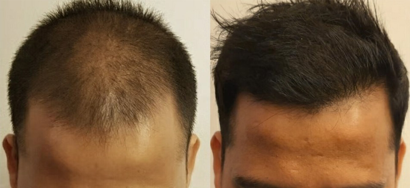Before After - Image 2