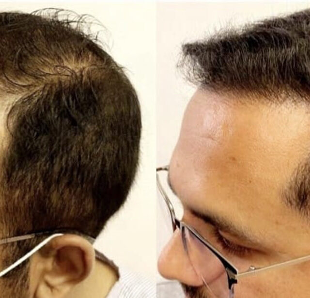 Before After - Image 3