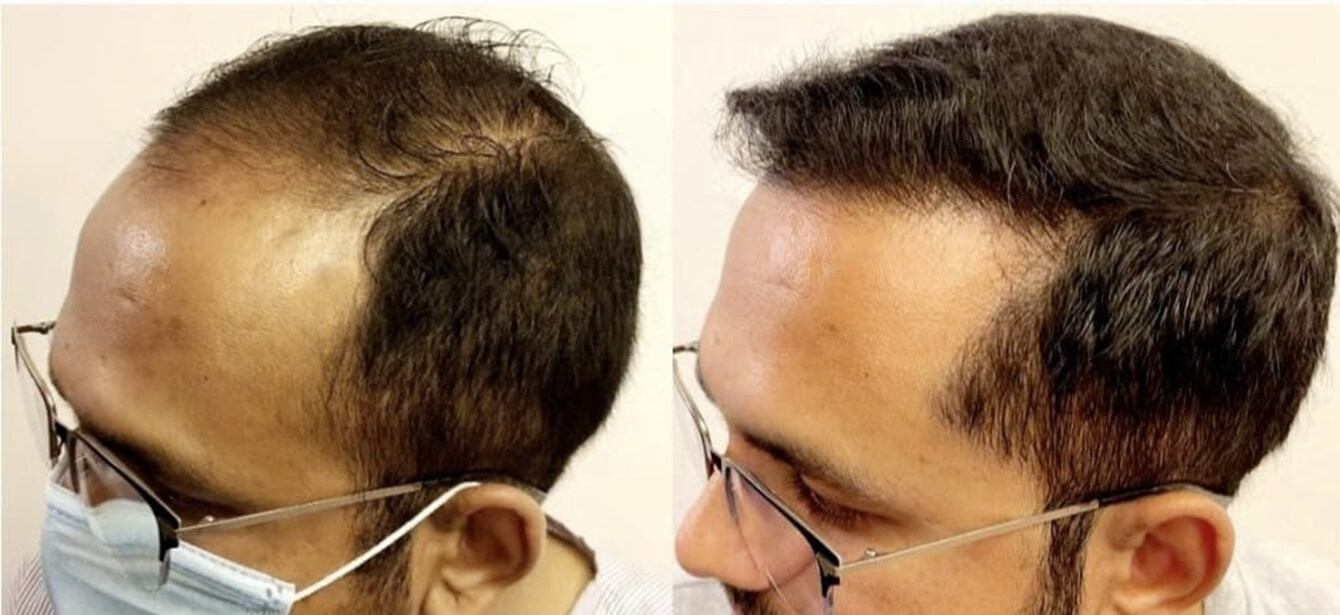 Before After - Image 3