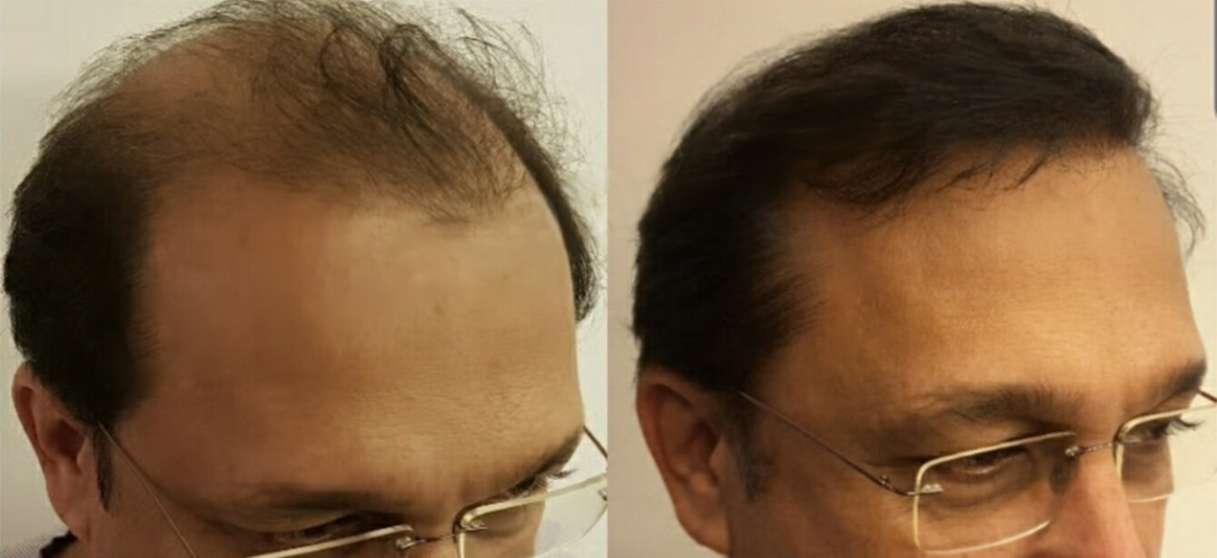 Before After - Image 4