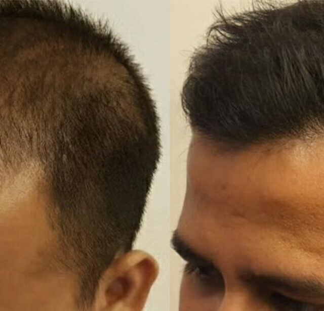 Before After - Image 5