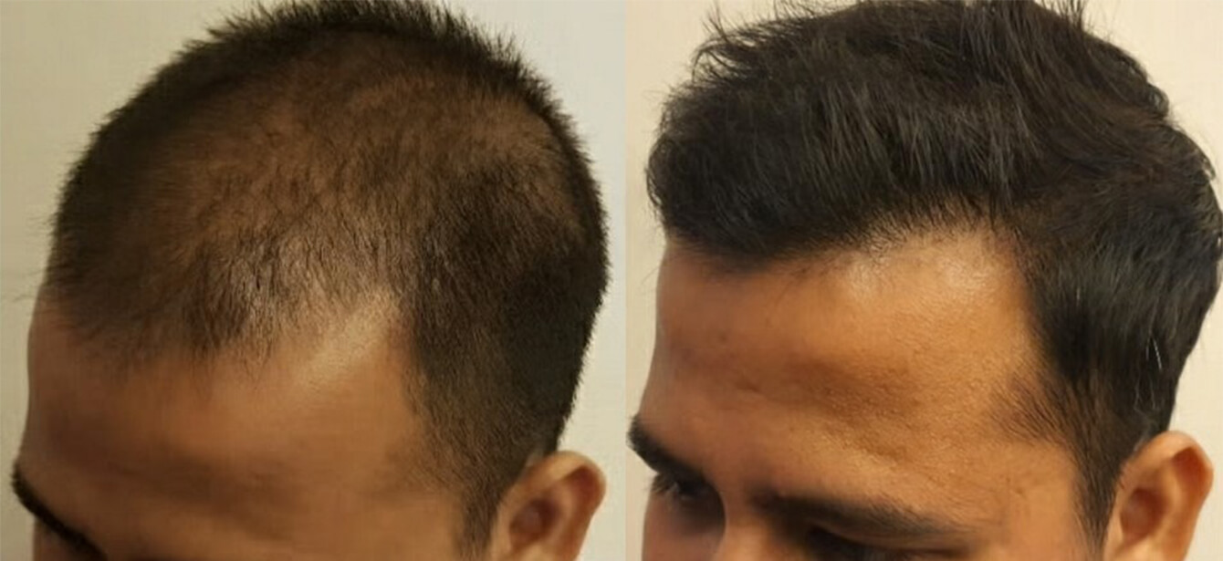 Before After - Image 5
