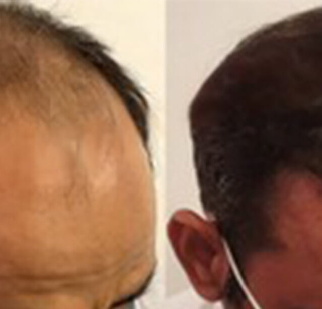 Before After - Image 6