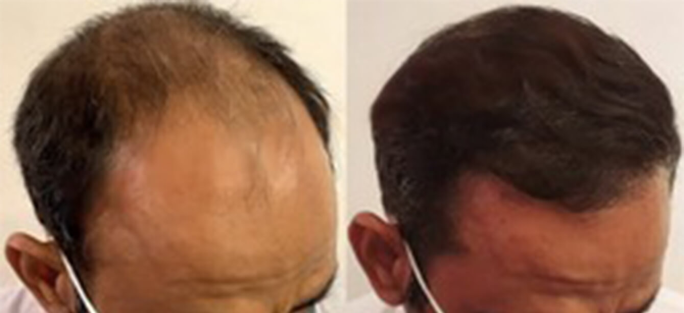 Before After - Image 6