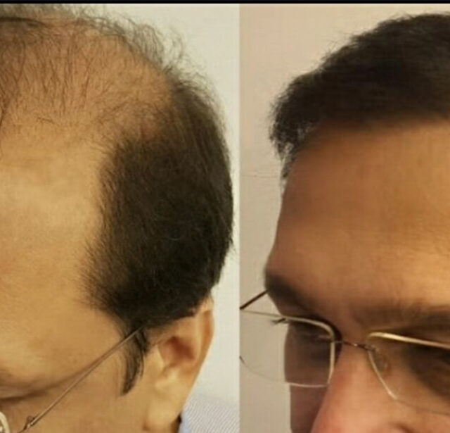 Before After - Image 10