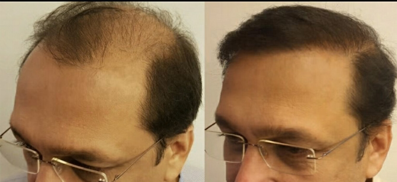 Before After - Image 10