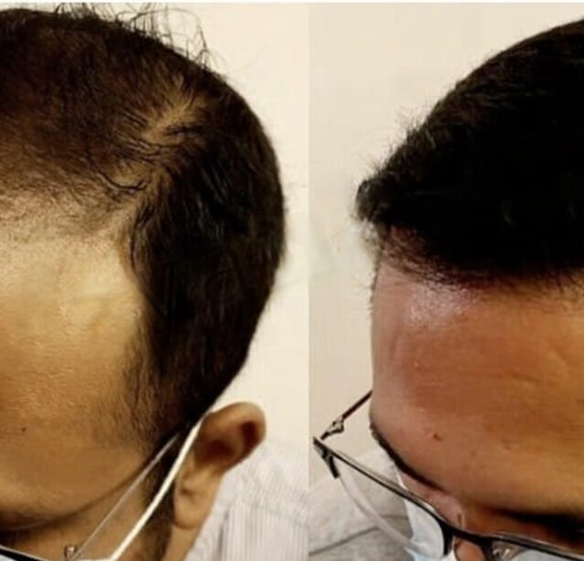 Before After - Image 11