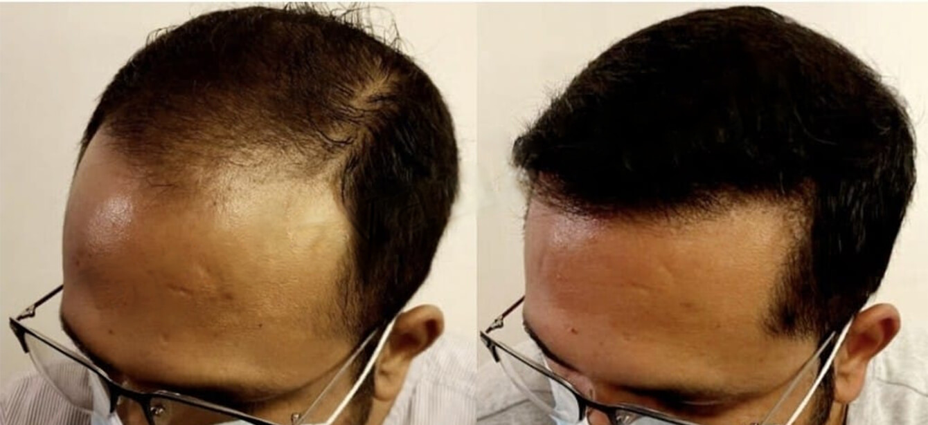 Before After - Image 11