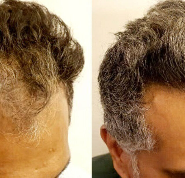 Before After - Image 12