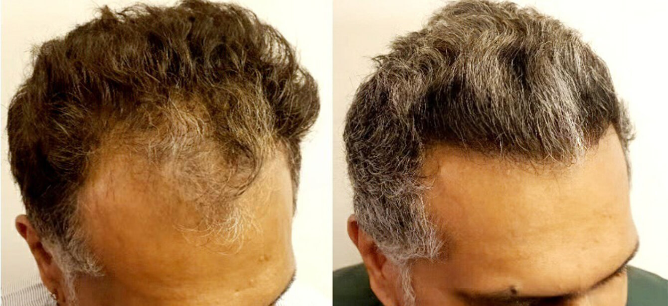 Before After - Image 12