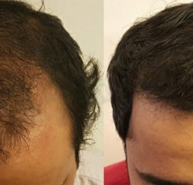 Before After - Image 13