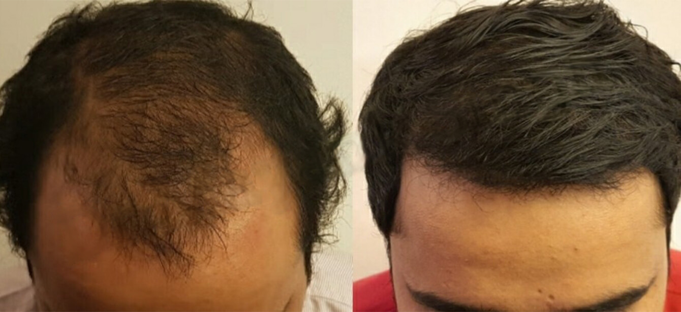 Before After - Image 13