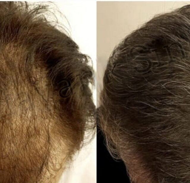 Before After - Image 14