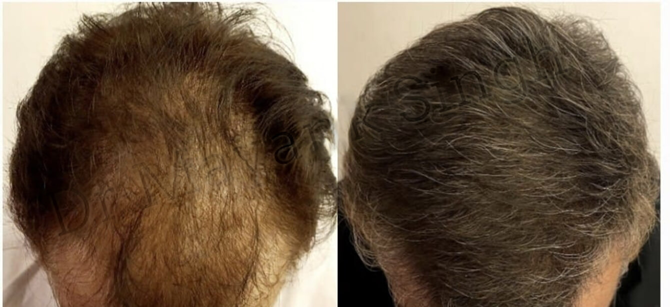 Before After - Image 14