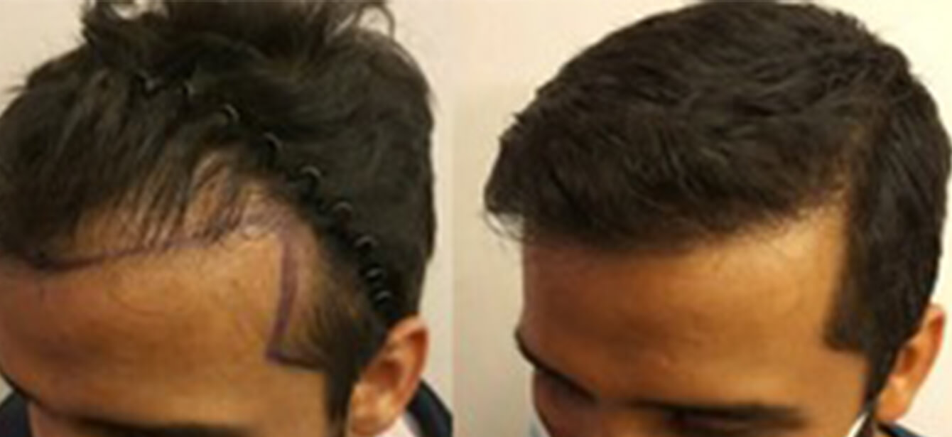 Before After - Image 7
