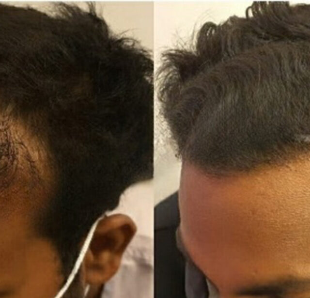 Before After - Image 8
