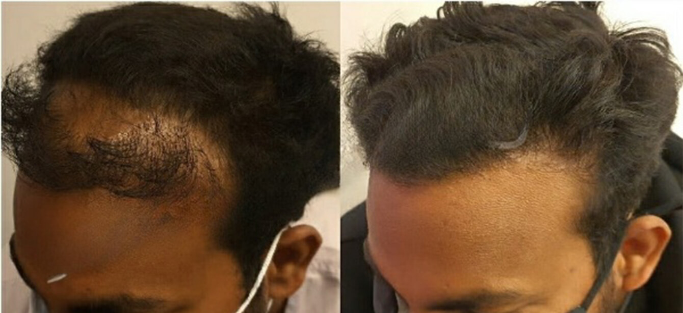Before After - Image 9