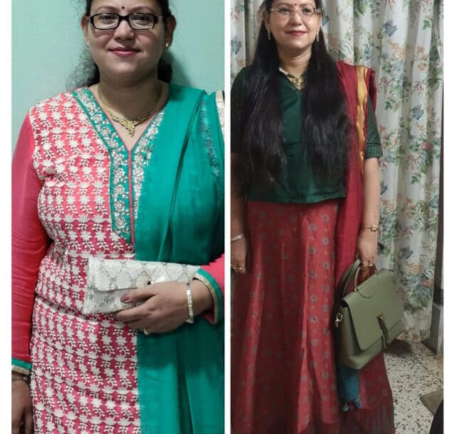 Weight loss B-A 2