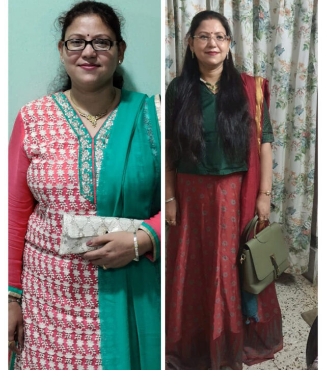 Weight loss B-A 2