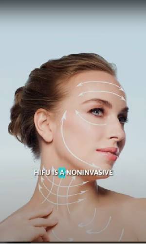 Laser Hair Reduction