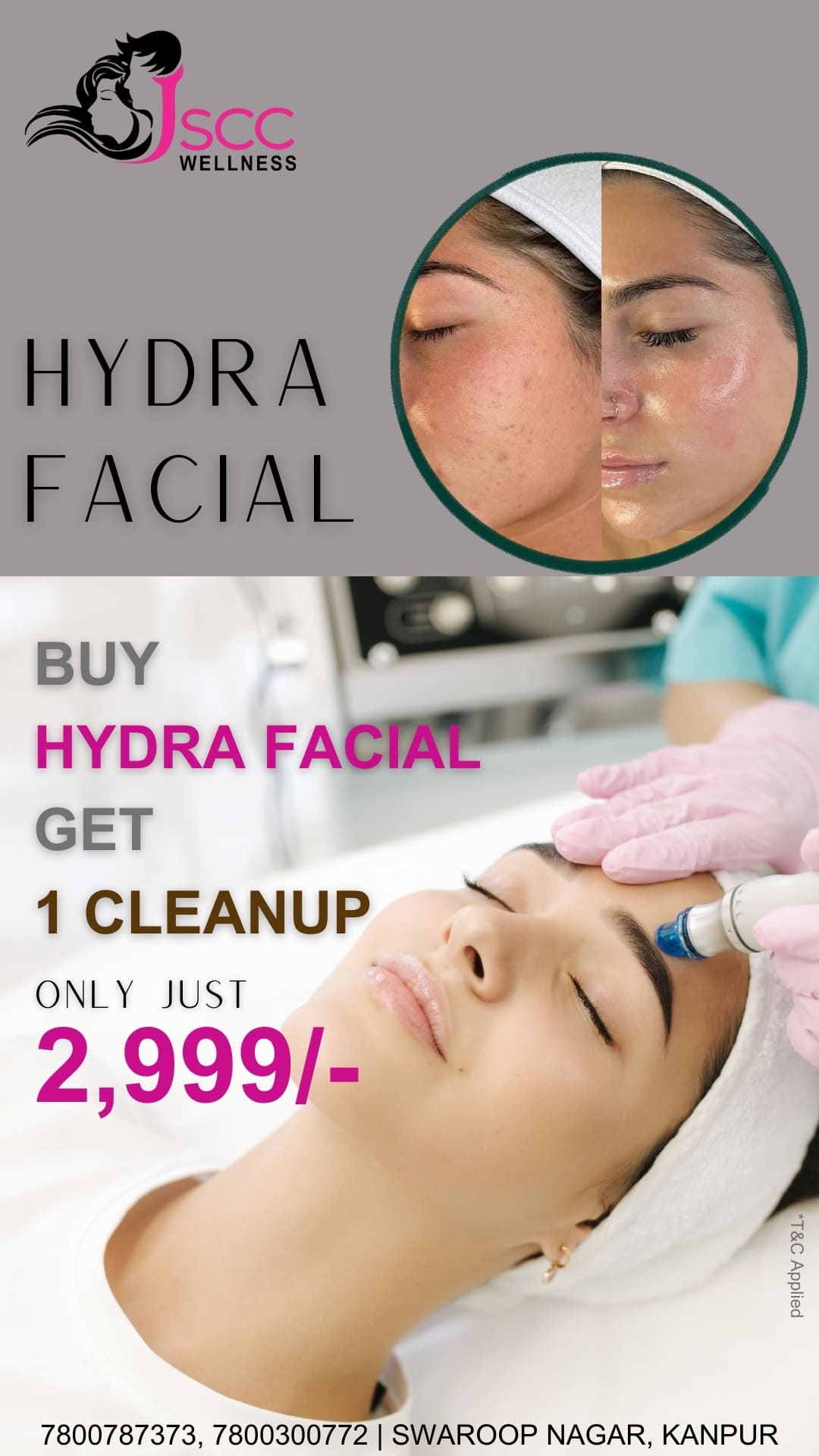 Hydra Facial