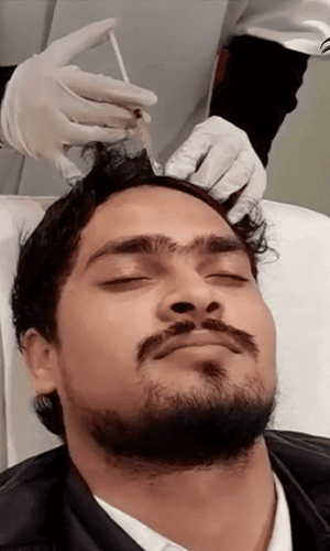 Hair Treatment