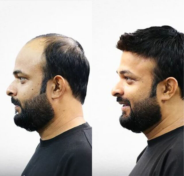 jscc-before-after-april-3 jscc-before-after-april-3