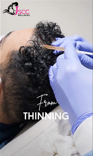 Laser Hair Reduction